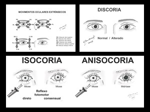 Ilustrações para capítulo de neurologia/oftalmologia