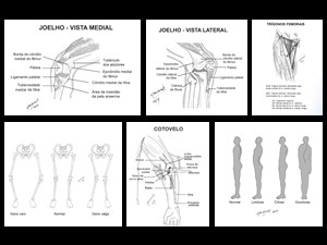 Ilustrações para capítulo de ortopedia