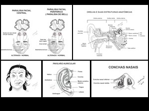 Ilustrações para capítulo de otorrinolaringologia