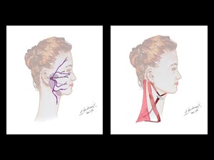 Perfil Facial: Nervo Facial, Parótida e Glândula Submandibular e Trígonos Cervicais