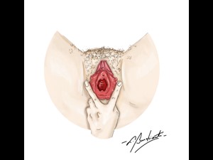 Abertura lábios vaginais (médico)