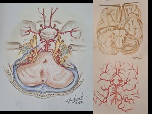 Emergência dos Nervos Craniano e Polígono de Willis: Originais